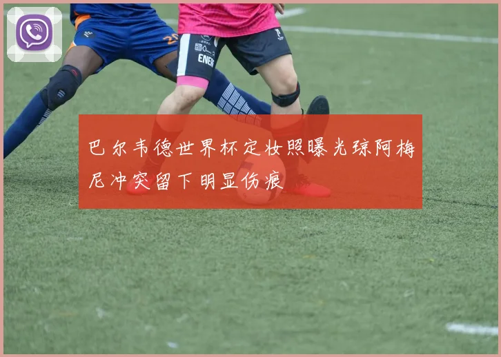 巴尔韦德世界杯定妆照曝光琼阿梅尼冲突留下明显伤痕